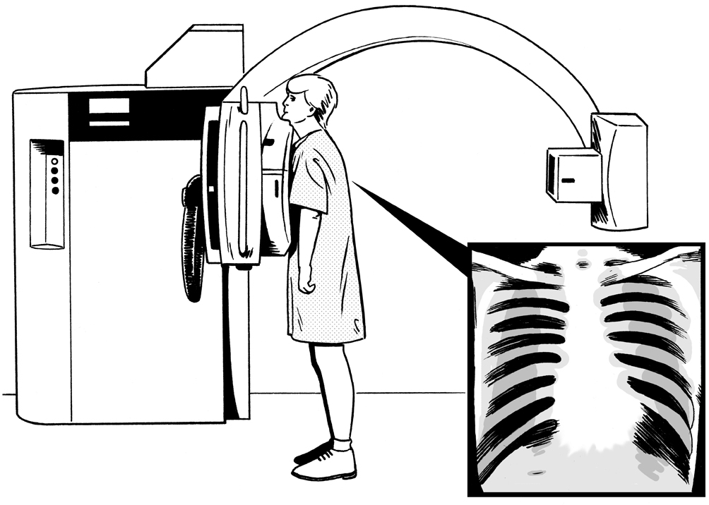 scan x-ray